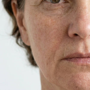 Before and after comparison of a woman's face with visible aging signs on the left and smoother skin on the right..