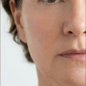 Before and after comparison of a woman's face with visible aging signs on the left and smoother skin on the right.