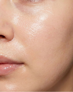 Before and after comparison of a person's face with a focus on skin texture.